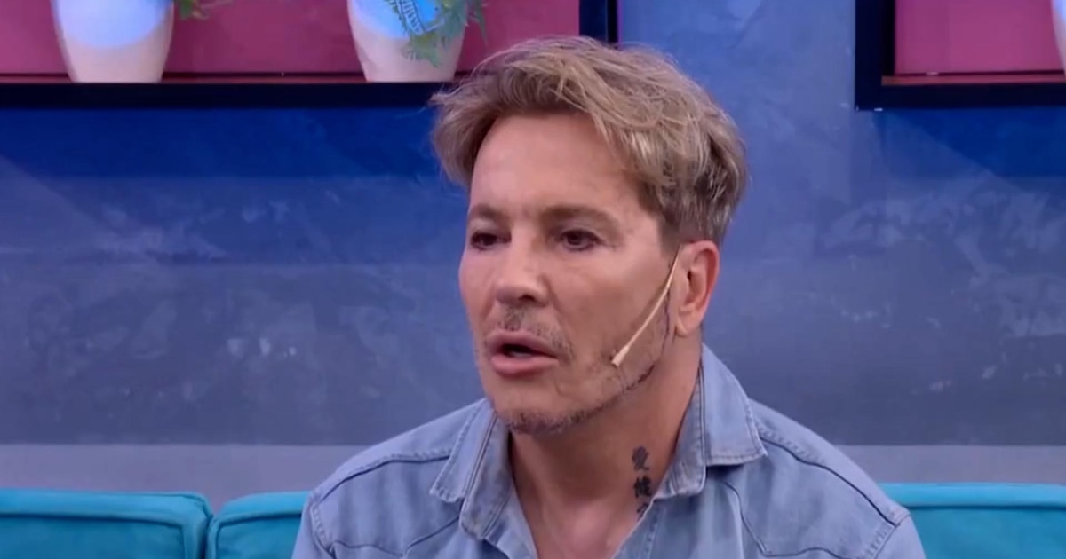 El impactante cambio de una celebridad tras su polémica cirugía estética